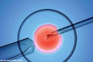 借精试管助孕